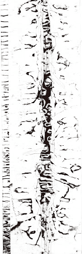 Cellulaire Cicatriciel I